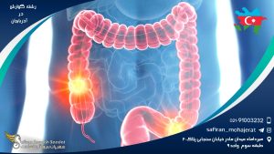 رشته گوارش در آذربایجان