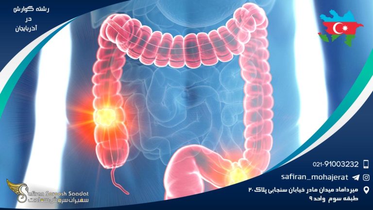رشته گوارش در آذربایجان