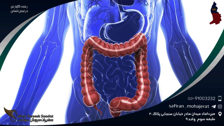 رشته گوارش در لیختن اشتاین