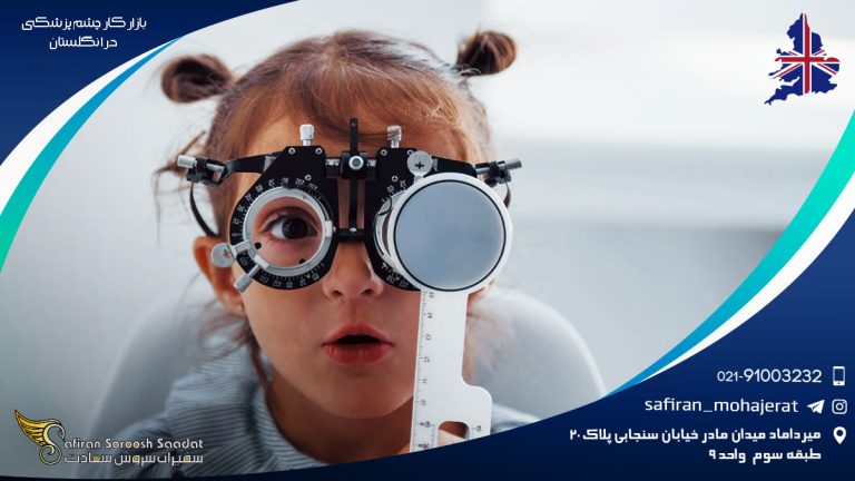 بازار کار چشم پزشکی در انگلستان
